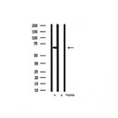 Western blot analysis of extracts from Hela, using PAK1 Antibody. Lane 1 was treated with the blocking peptide.