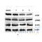 AF6432 at 1/100 staining Human prostate tissue by IHC-P. The sample was formaldehyde fixed and a heat mediated antigen retrieval step in citrate buffer was performed. The sample was then blocked and incubated with the antibody for 1.5 hours at 22¡ãC. An HRP conjugated goat anti-rabbit antibody was used as the secondary