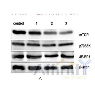 AF6432 at 1/100 staining Human prostate tissue by IHC-P. The sample was formaldehyde fixed and a heat mediated antigen retrieval step in citrate buffer was performed. The sample was then blocked and incubated with the antibody for 1.5 hours at 22¡ãC. An HRP conjugated goat anti-rabbit antibody was used as the secondary