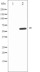 AF6435 staining U-2 OS? cells by IF/ICC. The sample were fixed with PFA and permeabilized in 0.1% Triton X-100,then blocked in 10% serum for 45 minutes at 25¡ãC. The primary antibody was diluted at 1/200 and incubated with the sample for 1 hour at 37¡ãC. An  Alexa Fluor 594 conjugated goat anti-rabbit IgG (H+L) antibody(Cat.
