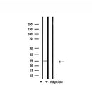 Western blot analysis of extracts from mouse brain, using RPL10 Antibody.