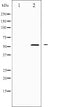 AF6438 at 1/100 staining Human lung tissue by IHC-P. The sample was formaldehyde fixed and a heat mediated antigen retrieval step in citrate buffer was performed. The sample was then blocked and incubated with the antibody for 1.5 hours at 22¡ãC. An HRP conjugated goat anti-rabbit antibody was used as the secondary