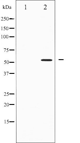 AF6438 at 1/100 staining Human lung tissue by IHC-P. The sample was formaldehyde fixed and a heat mediated antigen retrieval step in citrate buffer was performed. The sample was then blocked and incubated with the antibody for 1.5 hours at 22¡ãC. An HRP conjugated goat anti-rabbit antibody was used as the secondary