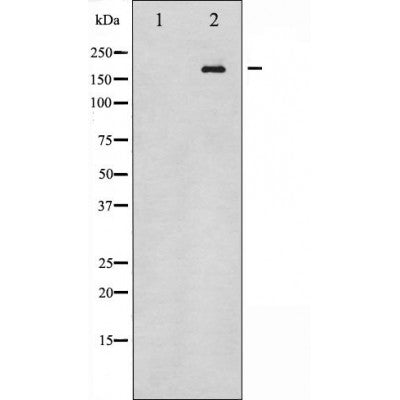 Western blot analysis of extracts from HUVEC, using HER4 Antibody. Lane 1 was treated with the blocking peptide.