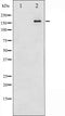 AF6446 staining HuvEc by IF/ICC. The sample were fixed with PFA and permeabilized in 0.1% Triton X-100,then blocked in 10% serum for 45 minutes at 25¡ãC. The primary antibody was diluted at 1/200 and incubated with the sample for 1 hour at 37¡ãC. An  Alexa Fluor 594 conjugated goat anti-rabbit IgG (H+L) Ab, diluted at 1/600, was used as the secondary antibod
