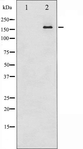 AF6446 staining HuvEc by IF/ICC. The sample were fixed with PFA and permeabilized in 0.1% Triton X-100,then blocked in 10% serum for 45 minutes at 25¡ãC. The primary antibody was diluted at 1/200 and incubated with the sample for 1 hour at 37¡ãC. An  Alexa Fluor 594 conjugated goat anti-rabbit IgG (H+L) Ab, diluted at 1/600, was used as the secondary antibod