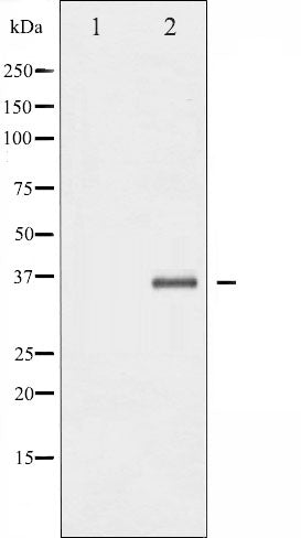 AF6448 staining HeLa by IF/ICC. The sample were fixed with PFA and permeabilized in 0.1% Triton X-100,then blocked in 10% serum for 45 minutes at 25¡ãC. The primary antibody was diluted at 1/200 and incubated with the sample for 1 hour at 37¡ãC. An  Alexa Fluor 594 conjugated goat anti-rabbit IgG (H+L) Ab, diluted at 1/600, was used as the secondary antibod