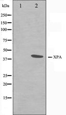 Western blot analysis on COLO205 cell lysate using XPA Antibody.The lane on the left is treated with the antigen-specific peptide.