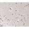 AF0294 at 1/100 staining human brain tissue sections by IHC-P. The tissue was formaldehyde fixed and a heat mediated antigen retrieval step in citrate buffer was performed. The tissue was then blocked and incubated with the antibody for 1.5 hours at 22¡ãC. An HRP conjugated goat anti-rabbit antibody was used as the secondary