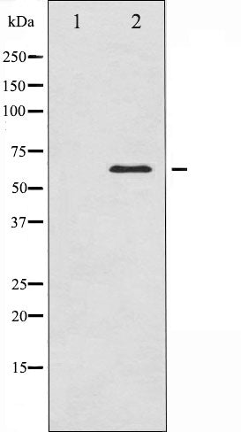 AF6452 staining HeLa by IF/ICC. The sample were fixed with PFA and permeabilized in 0.1% Triton X-100,then blocked in 10% serum for 45 minutes at 25¡ãC. The primary antibody was diluted at 1/200 and incubated with the sample for 1 hour at 37¡ãC. An  Alexa Fluor 594 conjugated goat anti-rabbit IgG (H+L) Ab, diluted at 1/600, was used as the secondary antibod