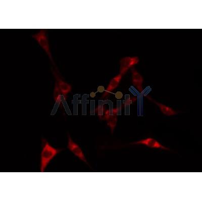 Western blot analysis of extracts from various samples, using LKB1 Antibody.
 Lane 1: Rat treated with blocking peptide;
 Lane 2: Rat;
Lane 3: Lung.