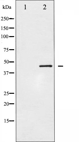 AF6458 at 1/100 staining Human prostate tissue by IHC-P. The sample was formaldehyde fixed and a heat mediated antigen retrieval step in citrate buffer was performed. The sample was then blocked and incubated with the antibody for 1.5 hours at 22¡ãC. An HRP conjugated goat anti-rabbit antibody was used as the secondary