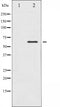 AF6460 at 1/100 staining Mouse testis tissue by IHC-P. The sample was formaldehyde fixed and a heat mediated antigen retrieval step in citrate buffer was performed. The sample was then blocked and incubated with the antibody for 1.5 hours at 22¡ãC. An HRP conjugated goat anti-rabbit antibody was used as the secondary