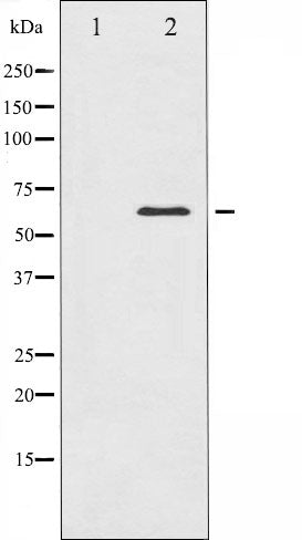AF6460 at 1/100 staining Mouse testis tissue by IHC-P. The sample was formaldehyde fixed and a heat mediated antigen retrieval step in citrate buffer was performed. The sample was then blocked and incubated with the antibody for 1.5 hours at 22¡ãC. An HRP conjugated goat anti-rabbit antibody was used as the secondary