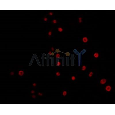 AF0295 staining 293 by IF/ICC. The sample were fixed with PFA and permeabilized in 0.1% Triton X-100,then blocked in 10% serum for 45 minutes at 25¡ãC. The primary antibody was diluted at 1/200 and incubated with the sample for 1 hour at 37¡ãC. An  Alexa Fluor 594 conjugated goat anti-rabbit IgG (H+L) Ab, diluted at 1/600, was used as the secondary antibod