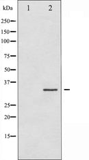 AF6463 at 1/100 staining Mouse liver tissue by IHC-P. The sample was formaldehyde fixed and a heat mediated antigen retrieval step in citrate buffer was performed. The sample was then blocked and incubated with the antibody for 1.5 hours at 22¡ãC. An HRP conjugated goat anti-rabbit antibody was used as the secondary