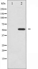 AF6465 staining HepG2 by IF/ICC. The sample were fixed with PFA and permeabilized in 0.1% Triton X-100,then blocked in 10% serum for 45 minutes at 25¡ãC. The primary antibody was diluted at 1/200 and incubated with the sample for 1 hour at 37¡ãC. An  Alexa Fluor 594 conjugated goat anti-rabbit IgG (H+L) Ab, diluted at 1/600, was used as the secondary antibod