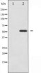 AF6465 staining HepG2 by IF/ICC. The sample were fixed with PFA and permeabilized in 0.1% Triton X-100,then blocked in 10% serum for 45 minutes at 25¡ãC. The primary antibody was diluted at 1/200 and incubated with the sample for 1 hour at 37¡ãC. An  Alexa Fluor 594 conjugated goat anti-rabbit IgG (H+L) Ab, diluted at 1/600, was used as the secondary antibod