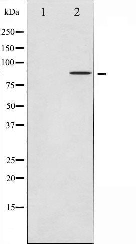 Western blot analysis of FRS2 expression in HUVEC whole cell lysates,The lane on the left is treated with the antigen-specific peptide.