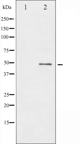 AF6467 at 1/100 staining Human liver cancer tissue by IHC-P. The sample was formaldehyde fixed and a heat mediated antigen retrieval step in citrate buffer was performed. The sample was then blocked and incubated with the antibody for 1.5 hours at 22¡ãC. An HRP conjugated goat anti-rabbit antibody was used as the secondary
