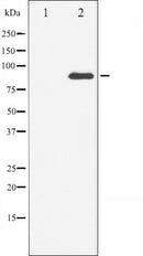 AF6468 at 1/100 staining Mouse lung tissue by IHC-P. The sample was formaldehyde fixed and a heat mediated antigen retrieval step in citrate buffer was performed. The sample was then blocked and incubated with the antibody for 1.5 hours at 22¡ãC. An HRP conjugated goat anti-rabbit antibody was used as the secondary