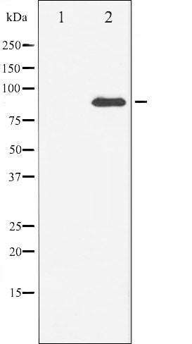 AF6468 at 1/100 staining Mouse lung tissue by IHC-P. The sample was formaldehyde fixed and a heat mediated antigen retrieval step in citrate buffer was performed. The sample was then blocked and incubated with the antibody for 1.5 hours at 22¡ãC. An HRP conjugated goat anti-rabbit antibody was used as the secondary
