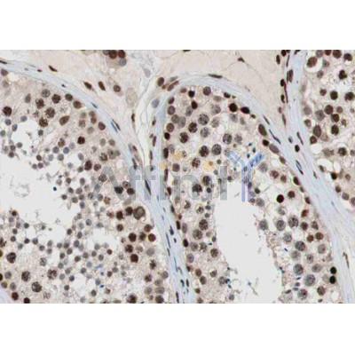 AF6469 staining HepG2 by IF/ICC. The sample were fixed with PFA and permeabilized in 0.1% Triton X-100,then blocked in 10% serum for 45 minutes at 25¡ãC. The primary antibody was diluted at 1/200 and incubated with the sample for 1 hour at 37¡ãC. An  Alexa Fluor 594 conjugated goat anti-rabbit IgG (H+L) Ab, diluted at 1/600, was used as the secondary antibod