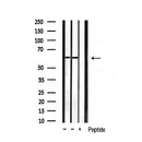 Western blot analysis of extracts from MCF7, using HDAC2 Antibody. Lane 1 was treated with the blocking peptide.