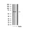 Western blot analysis of extracts from MCF7, using HDAC2 Antibody. Lane 1 was treated with the blocking peptide.