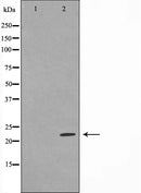 AF6471 at 1/100 staining Mouse testis tissue by IHC-P. The sample was formaldehyde fixed and a heat mediated antigen retrieval step in citrate buffer was performed. The sample was then blocked and incubated with the antibody for 1.5 hours at 22¡ãC. An HRP conjugated goat anti-rabbit antibody was used as the secondary