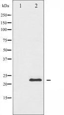 AF6472 at 1/100 staining Mouse testis tissue by IHC-P. The sample was formaldehyde fixed and a heat mediated antigen retrieval step in citrate buffer was performed. The sample was then blocked and incubated with the antibody for 1.5 hours at 22¡ãC. An HRP conjugated goat anti-rabbit antibody was used as the secondary