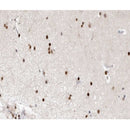 AF0296 at 1/100 staining human brain tissue sections by IHC-P. The tissue was formaldehyde fixed and a heat mediated antigen retrieval step in citrate buffer was performed. The tissue was then blocked and incubated with the antibody for 1.5 hours at 22¡ãC. An HRP conjugated goat anti-rabbit antibody was used as the secondary