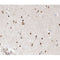 AF0296 at 1/100 staining human brain tissue sections by IHC-P. The tissue was formaldehyde fixed and a heat mediated antigen retrieval step in citrate buffer was performed. The tissue was then blocked and incubated with the antibody for 1.5 hours at 22¡ãC. An HRP conjugated goat anti-rabbit antibody was used as the secondary