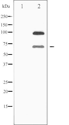 AF6474 at 1/100 staining Human gastric tissue by IHC-P. The sample was formaldehyde fixed and a heat mediated antigen retrieval step in citrate buffer was performed. The sample was then blocked and incubated with the antibody for 1.5 hours at 22¡ãC. An HRP conjugated goat anti-rabbit antibody was used as the secondary