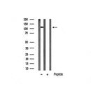 AF6490 staining HepG2 by IF/ICC. The sample were fixed with PFA and permeabilized in 0.1% Triton X-100,then blocked in 10% serum for 45 minutes at 25¡ãC. The primary antibody was diluted at 1/200 and incubated with the sample for 1 hour at 37¡ãC. An  Alexa Fluor 594 conjugated goat anti-rabbit IgG (H+L) Ab, diluted at 1/600, was used as the secondary antibod