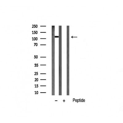 AF6490 staining HepG2 by IF/ICC. The sample were fixed with PFA and permeabilized in 0.1% Triton X-100,then blocked in 10% serum for 45 minutes at 25¡ãC. The primary antibody was diluted at 1/200 and incubated with the sample for 1 hour at 37¡ãC. An  Alexa Fluor 594 conjugated goat anti-rabbit IgG (H+L) Ab, diluted at 1/600, was used as the secondary antibod