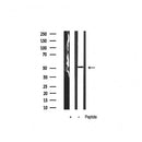 AF6492 at 1/100 staining Mouse intestine tissue by IHC-P. The sample was formaldehyde fixed and a heat mediated antigen retrieval step in citrate buffer was performed. The sample was then blocked and incubated with the antibody for 1.5 hours at 22¡ãC. An HRP conjugated goat anti-rabbit antibody was used as the secondary