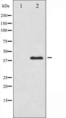 AF6494 at 1/100 staining Rat lung tissue by IHC-P. The sample was formaldehyde fixed and a heat mediated antigen retrieval step in citrate buffer was performed. The sample was then blocked and incubated with the antibody for 1.5 hours at 22¡ãC. An HRP conjugated goat anti-rabbit antibody was used as the secondary