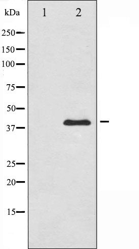AF6494 at 1/100 staining Rat lung tissue by IHC-P. The sample was formaldehyde fixed and a heat mediated antigen retrieval step in citrate buffer was performed. The sample was then blocked and incubated with the antibody for 1.5 hours at 22¡ãC. An HRP conjugated goat anti-rabbit antibody was used as the secondary