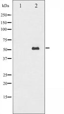 AF6497 at 1/100 staining Mouse muscle tissue by IHC-P. The sample was formaldehyde fixed and a heat mediated antigen retrieval step in citrate buffer was performed. The sample was then blocked and incubated with the antibody for 1.5 hours at 22¡ãC. An HRP conjugated goat anti-rabbit antibody was used as the secondary