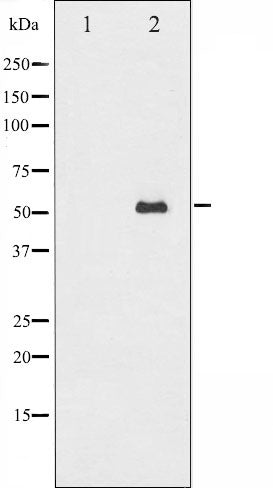 AF6497 at 1/100 staining Mouse muscle tissue by IHC-P. The sample was formaldehyde fixed and a heat mediated antigen retrieval step in citrate buffer was performed. The sample was then blocked and incubated with the antibody for 1.5 hours at 22¡ãC. An HRP conjugated goat anti-rabbit antibody was used as the secondary