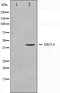 Western blot analysis on COLO205 cell lysate using XRCC4 Antibody.The lane on the left is treated with the antigen-specific peptide.