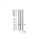 AF7008 staining lovo cells by ICC/IF. Cells were fixed with PFA and permeabilized in 0.1% saponin prior to blocking in 10% serum for 45 minutes at 37¡ãC. The primary antibody was diluted 1/400 and incubated with the sample for 1 hour at 37¡ãC. A  Alexa Fluor? 594 conjugated goat polyclonal to rabbit IgG (H+L), diluted 1/600 was used as secondary antibod
