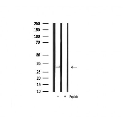AF0931 staining A-431 cells by IF/ICC. The sample were fixed with PFA and permeabilized in 0.1% Triton X-100,then blocked in 10% serum for 45 minutes at 25¡ãC. The primary antibody was diluted at 1/200 and incubated with the sample for 1 hour at 37¡ãC. An  Alexa Fluor 594 conjugated goat anti-rabbit IgG (H+L) antibody(Cat.