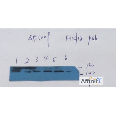 AF1009 staining HeLa cells by IF/ICC. The sample were fixed with PFA and permeabilized in 0.1% Triton X-100,then blocked in 10% serum for 45 minutes at 25¡ãC. The primary antibody was diluted at 1/200 and incubated with the sample for 1 hour at 37¡ãC. An  Alexa Fluor 594 conjugated goat anti-rabbit IgG (H+L) antibody(Cat.