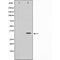 E-cadherin, ?-catenin, vimentin, MMP-2 and MMP-9 which are EMT-related proteins, were assessed in terms of expression levels. EMT-related transcription factors (Snail, Slug, Twist and ZEB1) were measured in A549/PTX and A549/DDP cells using western blot analysis.
