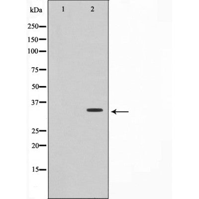 E-cadherin, ?-catenin, vimentin, MMP-2 and MMP-9 which are EMT-related proteins, were assessed in terms of expression levels. EMT-related transcription factors (Snail, Slug, Twist and ZEB1) were measured in A549/PTX and A549/DDP cells using western blot analysis.