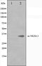 Western blot analysis on K562 cell lysate using NKX6.3 Antibody.The lane on the left is treated with the antigen-specific peptide.