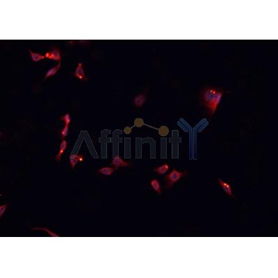 AF0302 staining SNKSH cells by IF/ICC. The sample were fixed with PFA and permeabilized in 0.1% Triton X-100,then blocked in 10% serum for 45 minutes at 25¡ãC. The primary antibody was diluted at 1/200 and incubated with the sample for 1 hour at 37¡ãC. An  Alexa Fluor 594 conjugated goat anti-rabbit IgG (H+L) antibody(Cat.