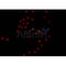 AF0302 staining K562 by IF/ICC. The sample were fixed with PFA and permeabilized in 0.1% Triton X-100,then blocked in 10% serum for 45 minutes at 25¡ãC. The primary antibody was diluted at 1/200 and incubated with the sample for 1 hour at 37¡ãC. An  Alexa Fluor 594 conjugated goat anti-rabbit IgG (H+L) Ab, diluted at 1/600, was used as the secondary antibod